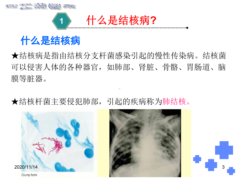 你我共同参与消除结核危害课件.ppt_第3页