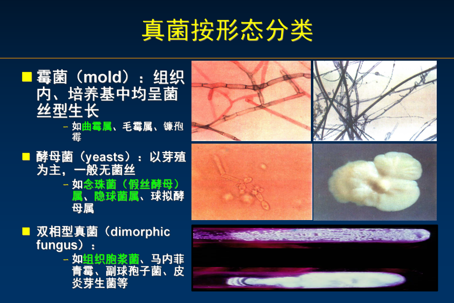 侵袭性肺曲霉病培训课件-2.ppt_第2页