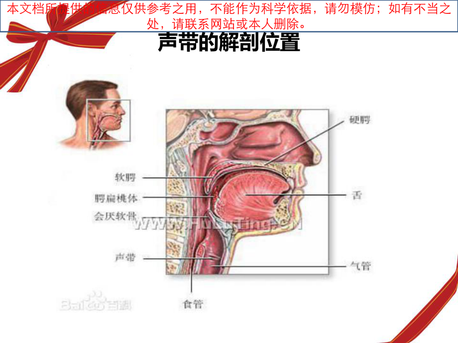 声带息肉的护理查房培训课件.ppt_第3页