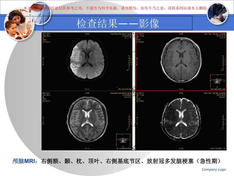 内科大查房专业知识宣讲培训课件.ppt_第3页