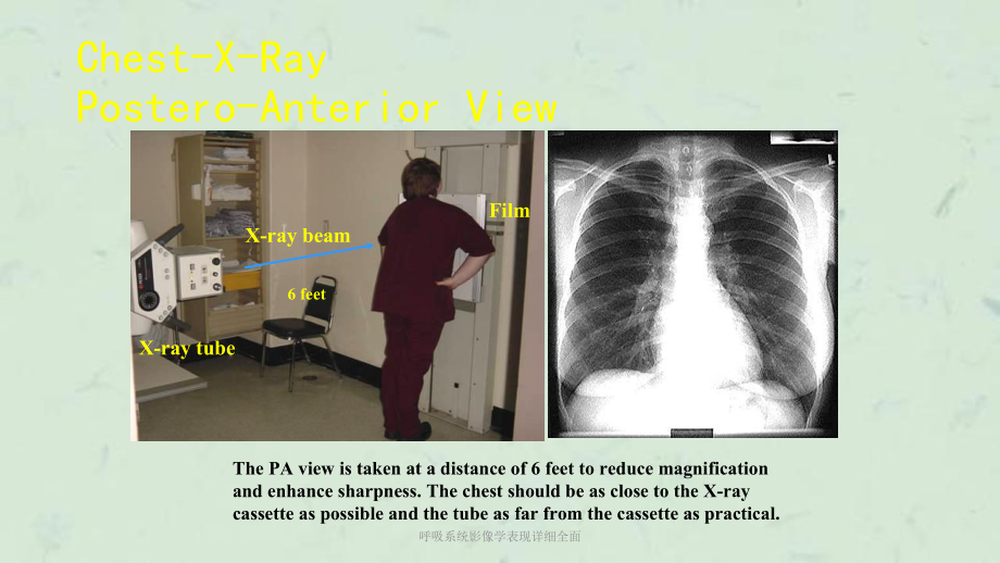 呼吸系统影像学表现详细全面课件.ppt_第3页