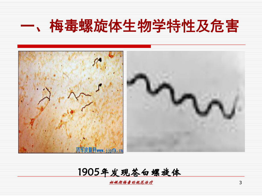 妊娠期梅毒的规范治疗培训课件.ppt_第3页