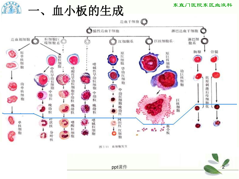 原发性血小板增多症的诊断与治疗-课件.ppt_第2页