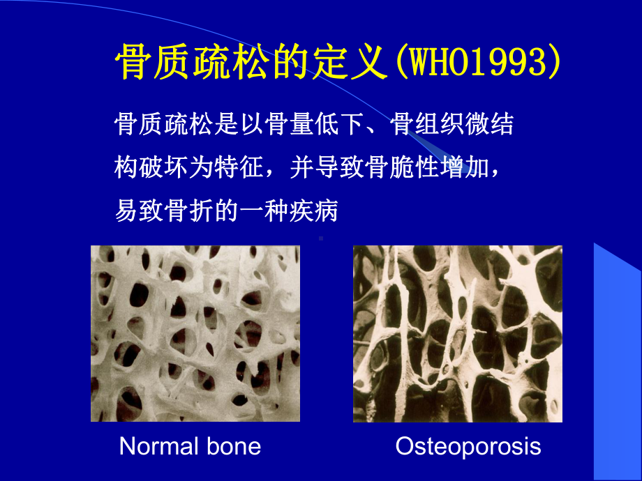 原发性骨质疏松症的药物治疗课件.ppt_第2页