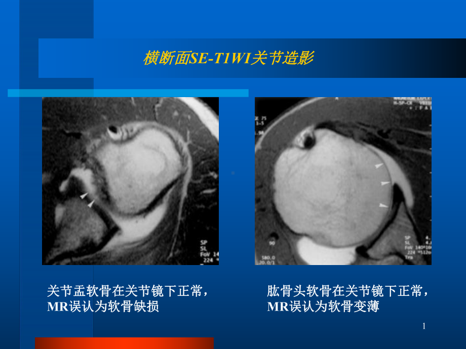 关节软骨课件.ppt_第1页