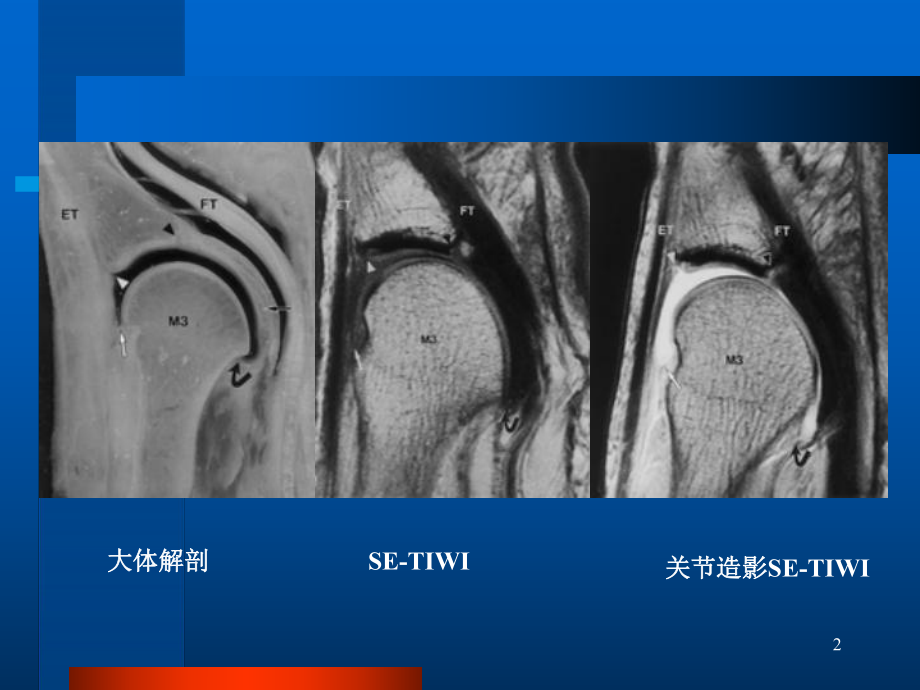 关节软骨课件.ppt_第2页