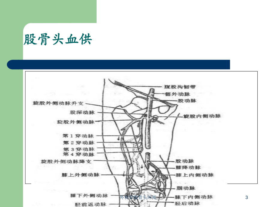 外科学股骨头坏死培训课件.ppt_第3页