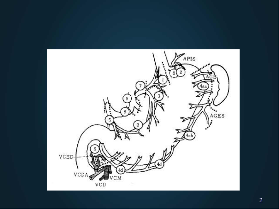 医学课件-胃癌的淋巴结分组课件.ppt_第2页