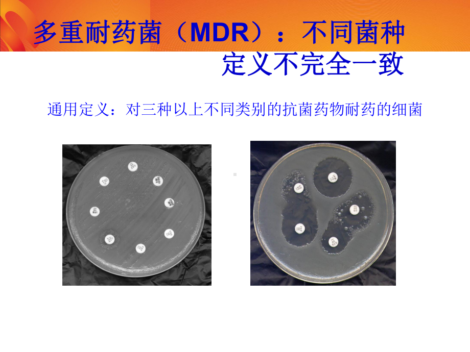 多重耐药革兰阴性菌感染与治疗课件.ppt_第2页