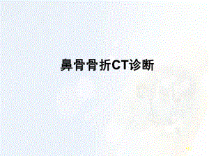 医学课件-鼻骨骨折CT诊断课件.ppt