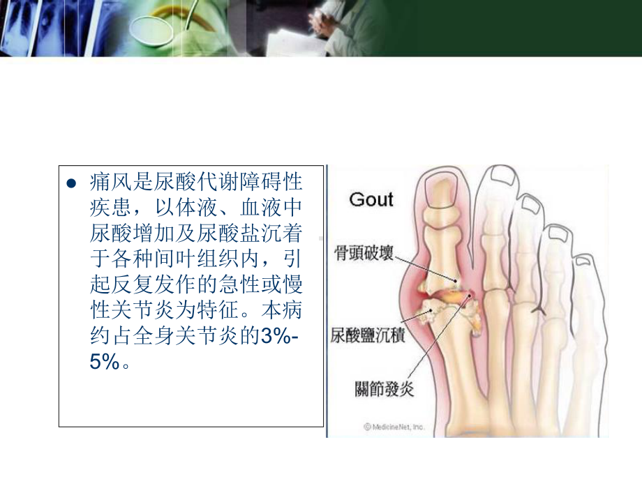 医学课件-痛风结节的影像表现课件.ppt_第2页