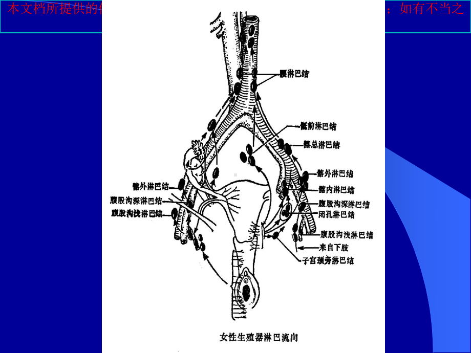 妇科肿瘤的放射治疗培训课件.ppt_第3页