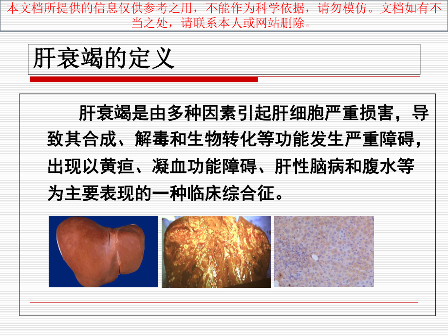 人工肝医学课件培训课件.ppt_第1页