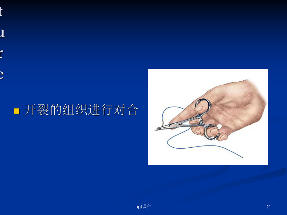 外科常用吻合和缝合技术-课件.ppt_第2页