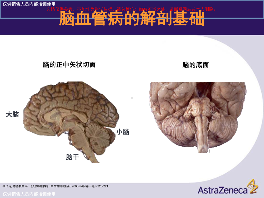 卒中和短暂性脑缺血培训课件.ppt_第2页