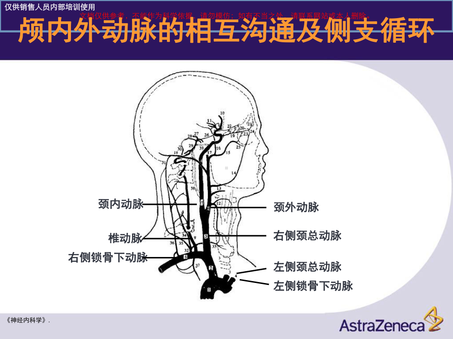 卒中和短暂性脑缺血培训课件.ppt_第3页