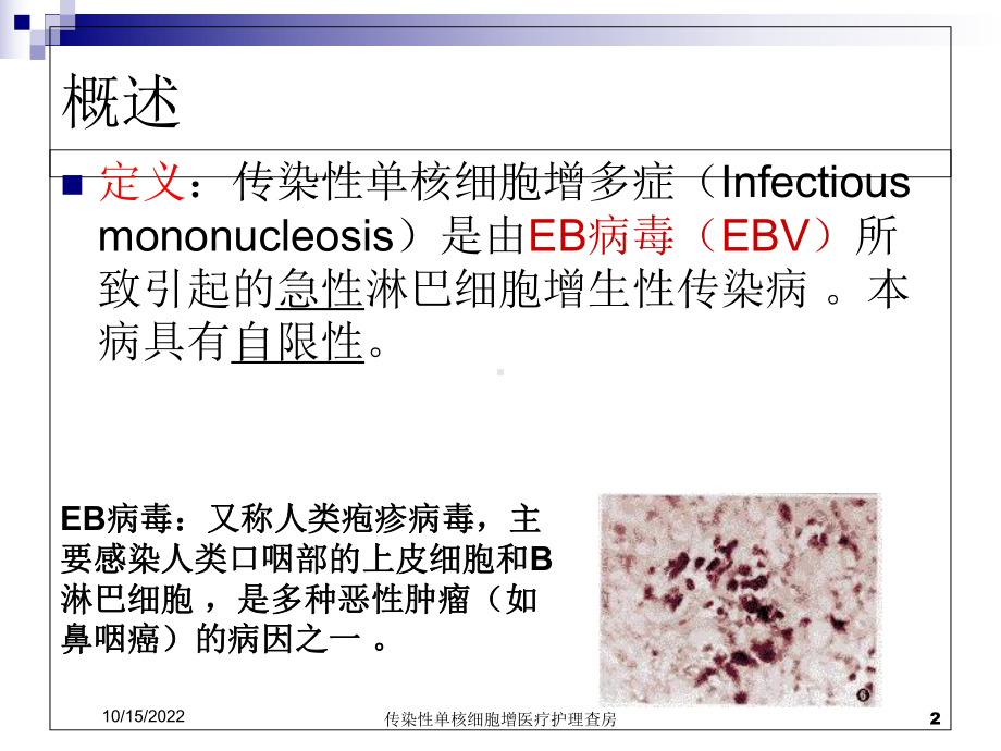 传染性单核细胞增医疗护理查房课件.ppt_第2页