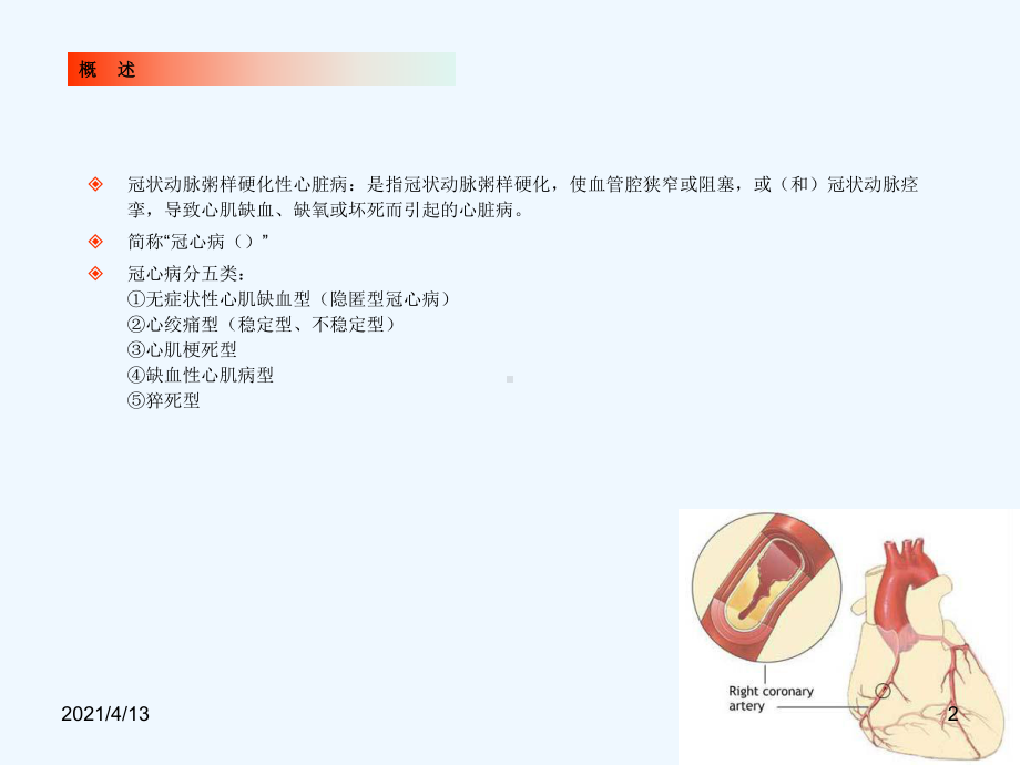 全科医生培训-冠心病摘要课件.ppt_第2页