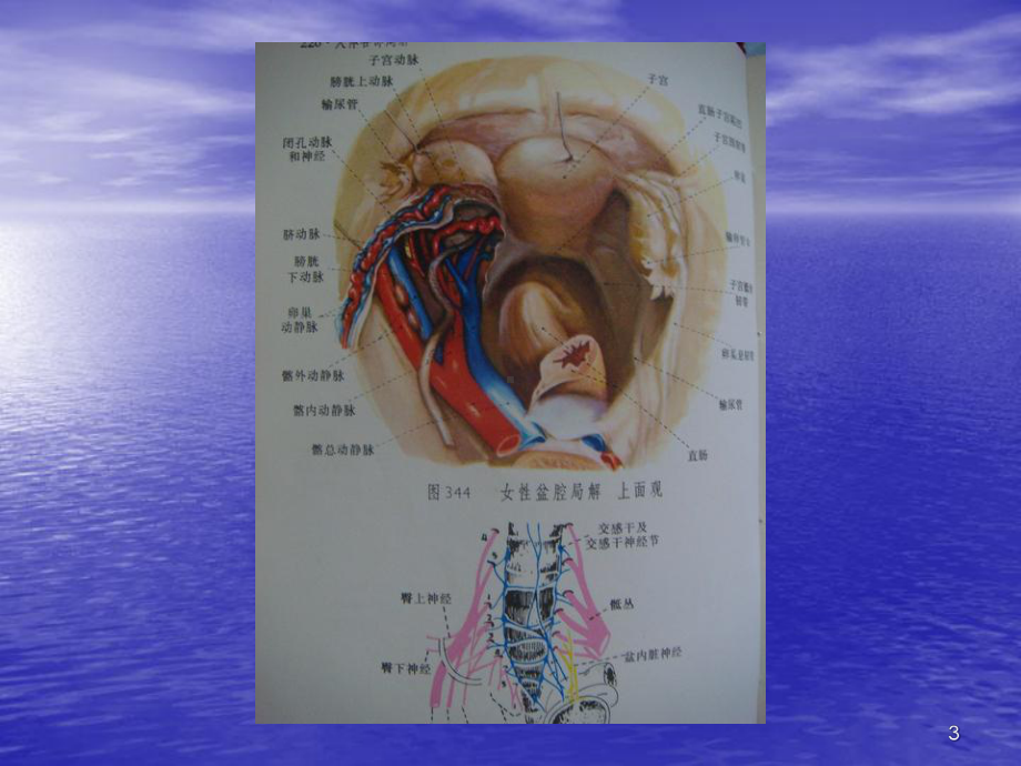 子宫肌瘤CT影像分析课件.ppt_第3页