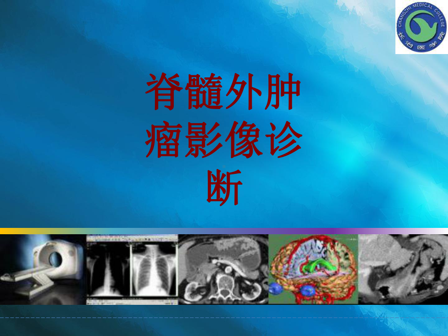 医学脊髓外肿瘤影像诊断培训课件.ppt_第1页