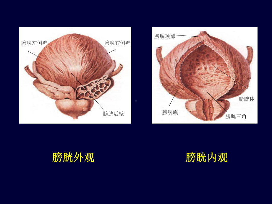 医学课件膀胱超声专业知识.ppt_第3页