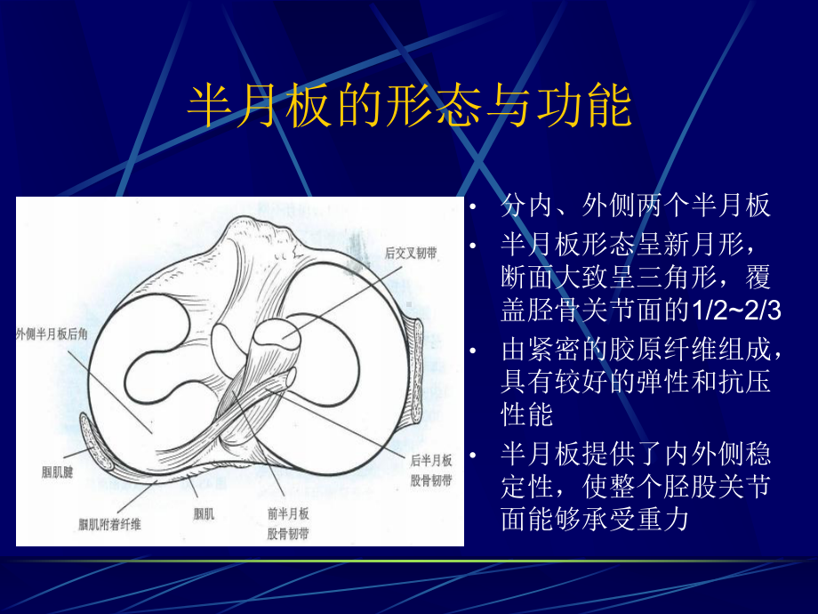 医学课件半月板损伤磁共振表现.ppt_第1页