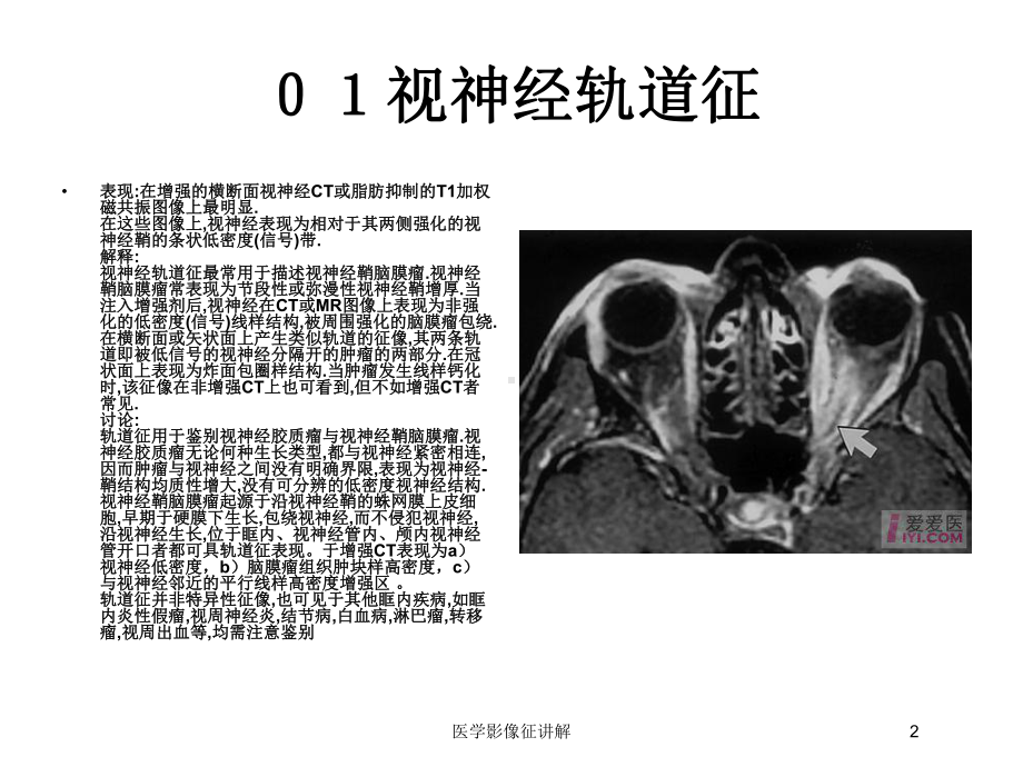 医学影像征讲解培训课件.ppt_第2页