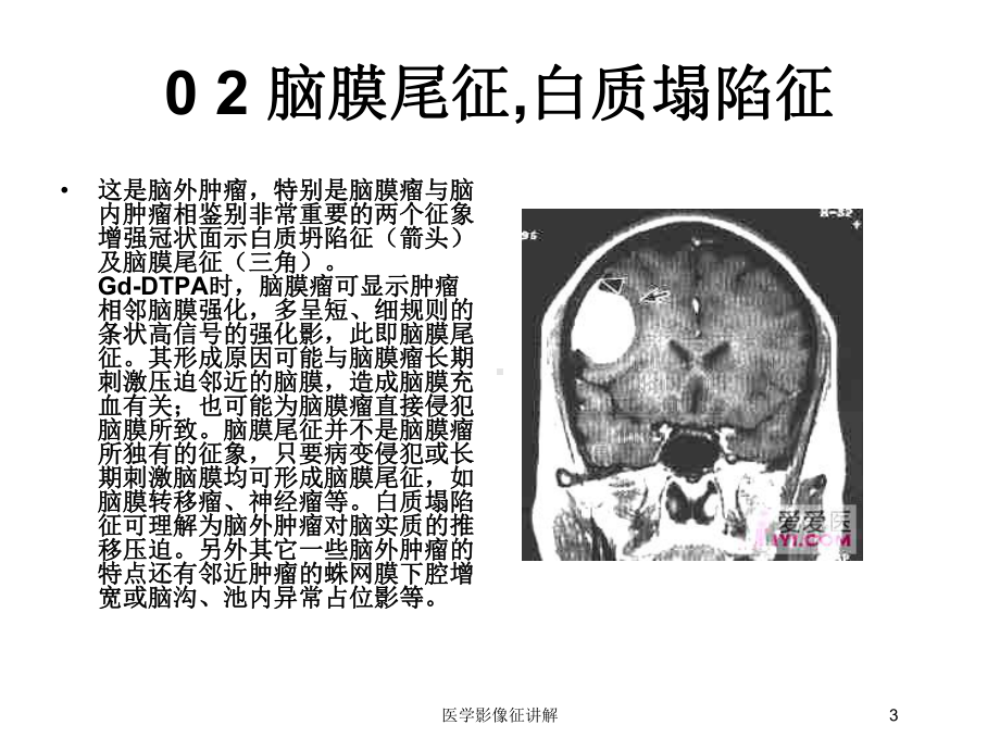 医学影像征讲解培训课件.ppt_第3页