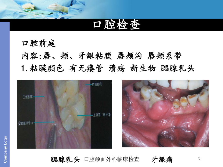 口腔颌面外科临床检查培训课件.ppt_第3页