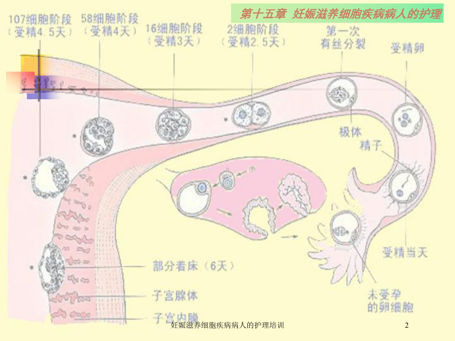 妊娠滋养细胞疾病病人的护理培训培训课件.ppt_第2页