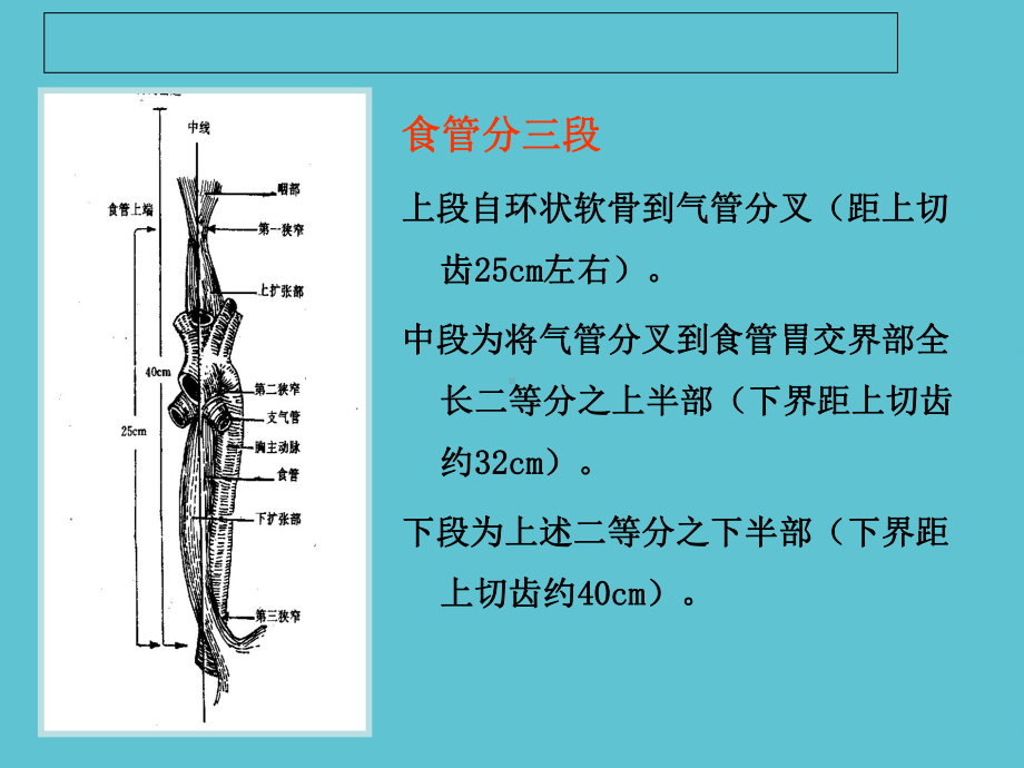 授课用-食管癌术前术后护理课件.ppt_第3页