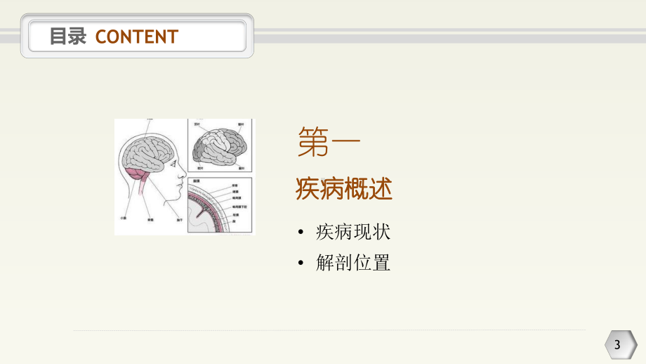 桥小脑角脑膜瘤课件.pptx_第3页