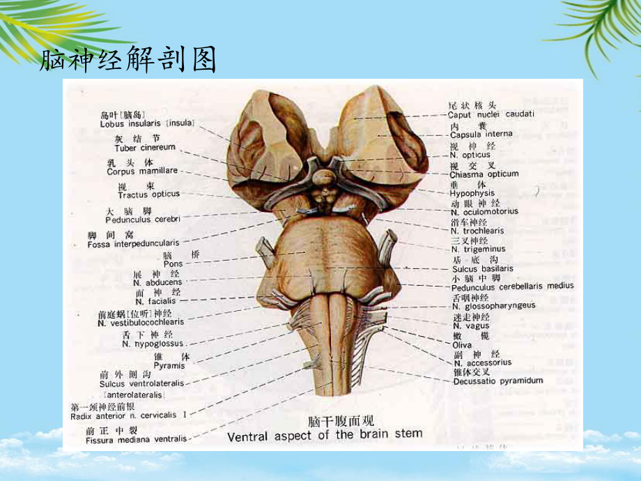 桥小脑肿瘤疾病护理全面课件.pptx_第3页