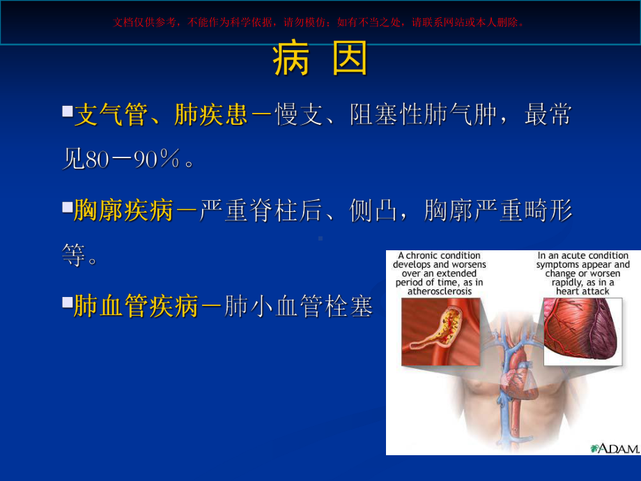 慢性肺源性心脏病专题知识培训课件.ppt_第3页