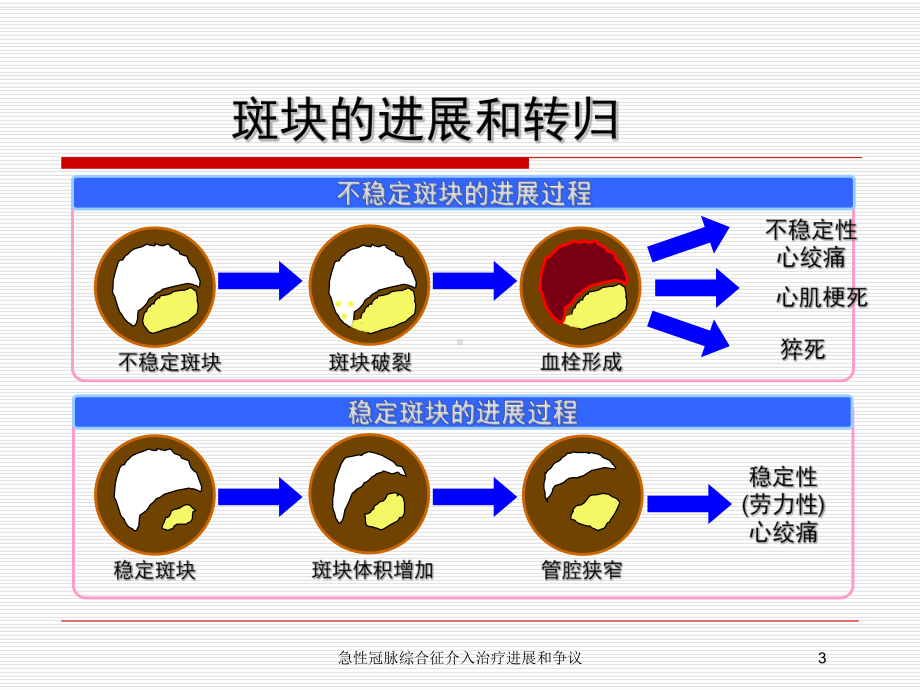 急性冠脉综合征介入治疗进展和争议培训课件.ppt_第3页