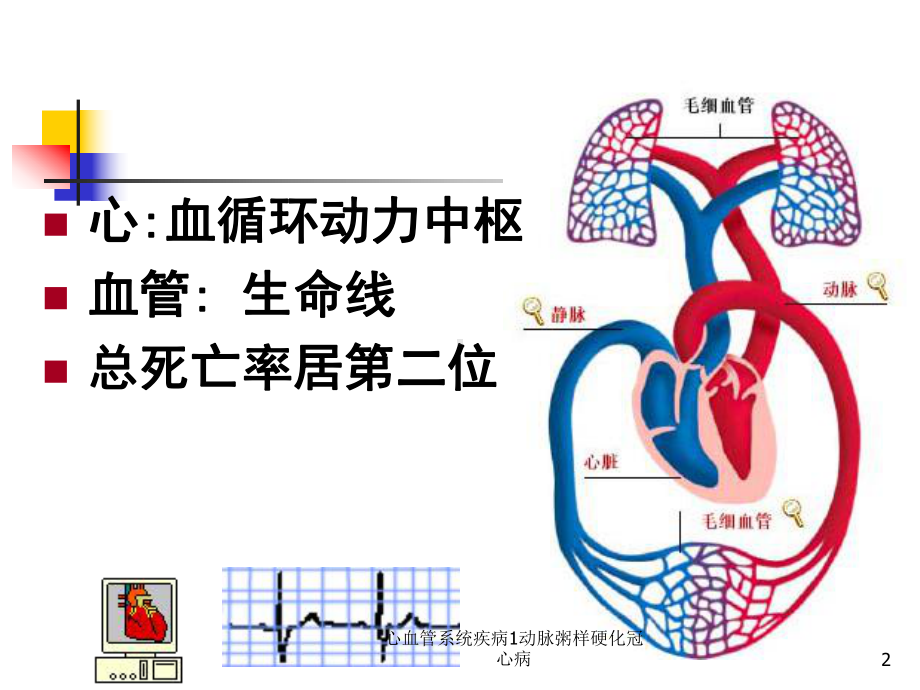 心血管系统疾病1动脉粥样硬化冠心病课件.ppt_第2页