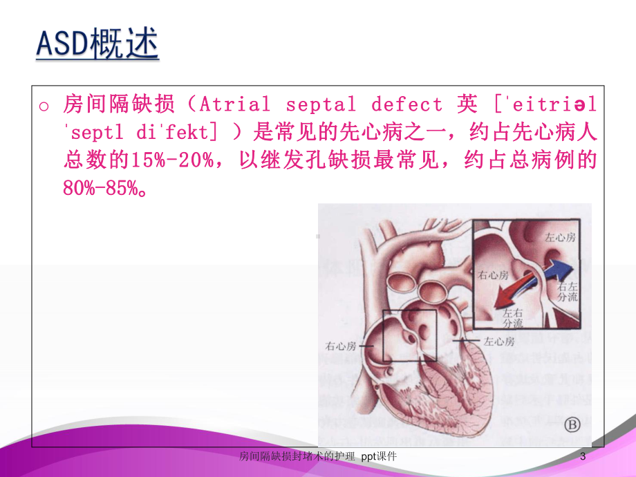 房间隔缺损封堵术的护理-课件.ppt_第3页