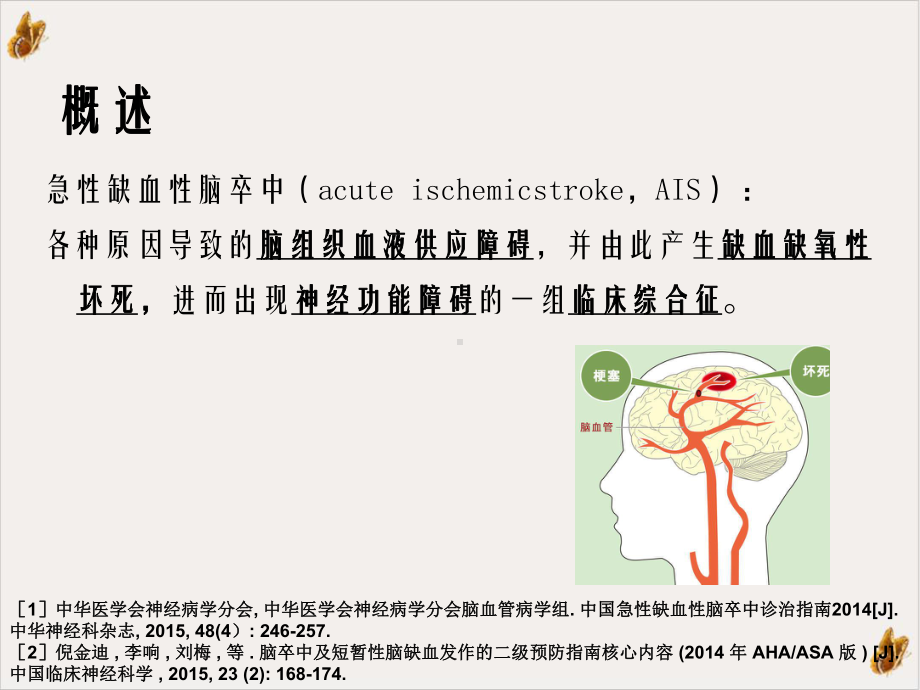 急性缺血性脑卒中的诊断和治疗课件.ppt_第2页