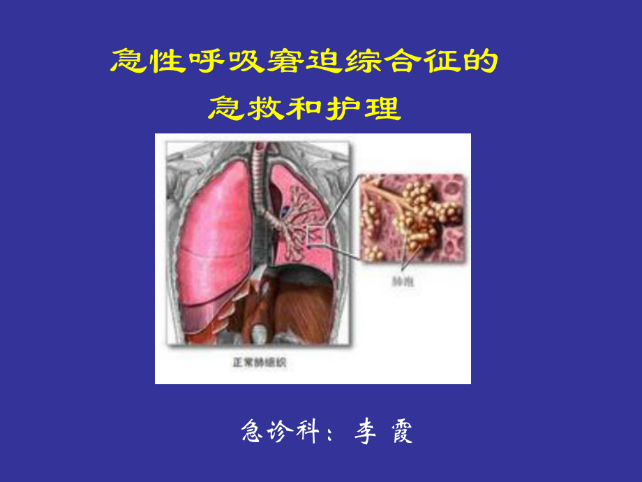 急性呼吸窘迫综合征的急救和护理教材课件.ppt_第1页