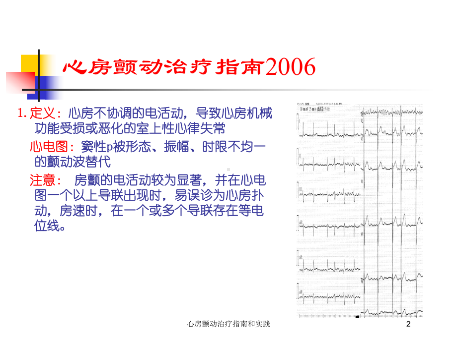 心房颤动治疗指南和实践培训课件.ppt_第2页