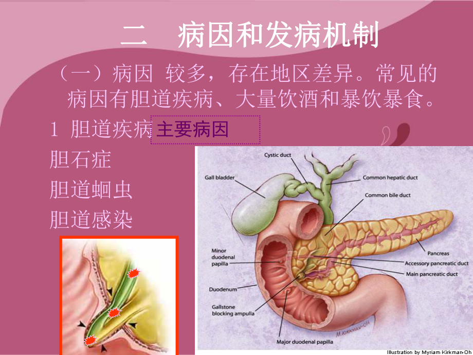 急性胰腺炎讲课件.ppt_第3页