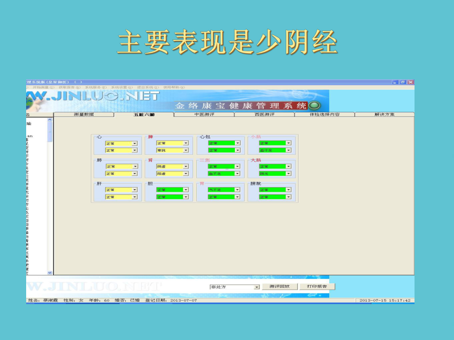 授课用-颅脑疾病与遗传及非遗传课件.ppt_第2页