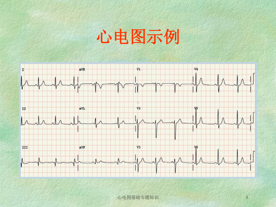 心电图基础专题知识培训课件.ppt_第3页