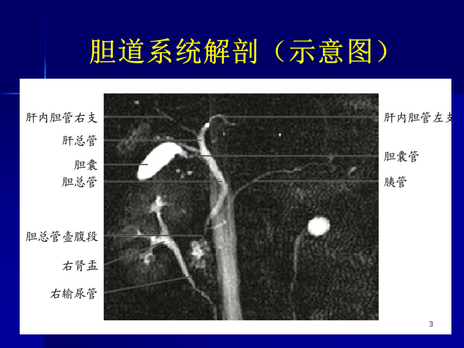 梗阻性黄疸影像诊断课件.ppt_第3页