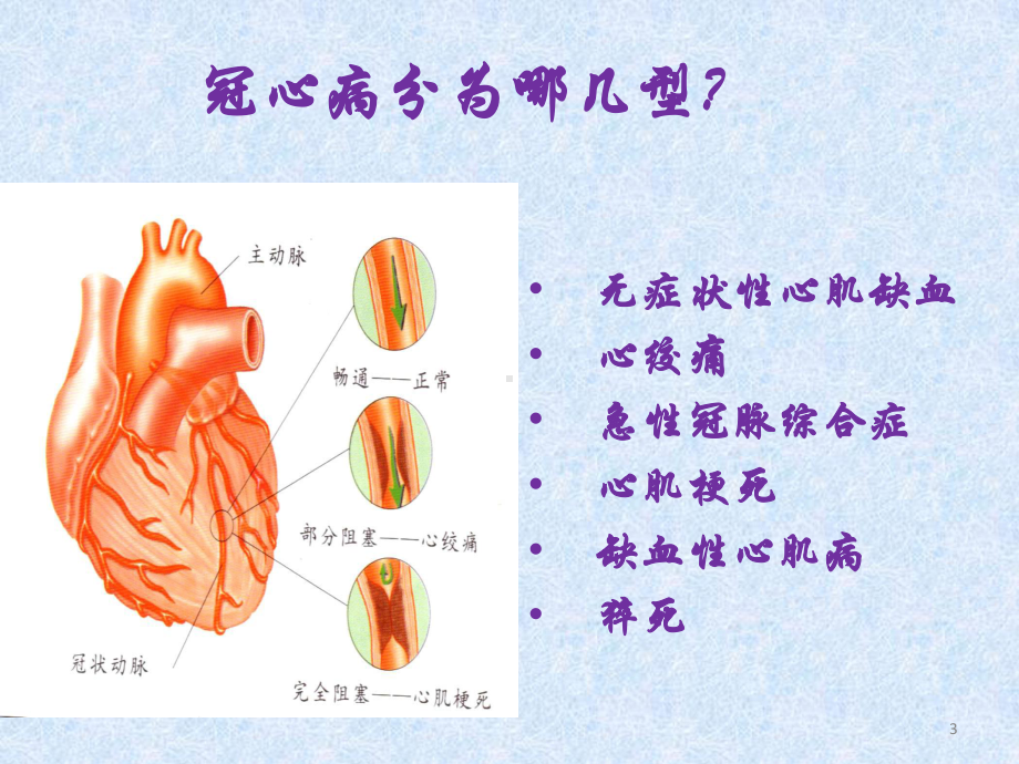 小讲课冠心病课件-2.pptx_第3页