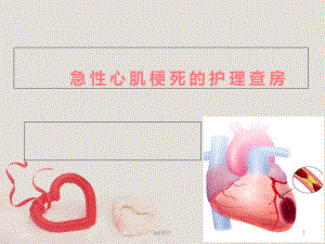 急性心肌梗死的护理查房-课件.ppt