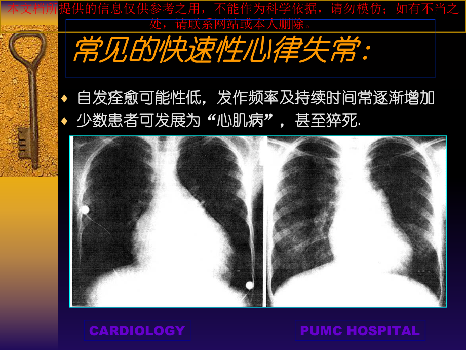 快速性心律失常培训课件.ppt_第3页