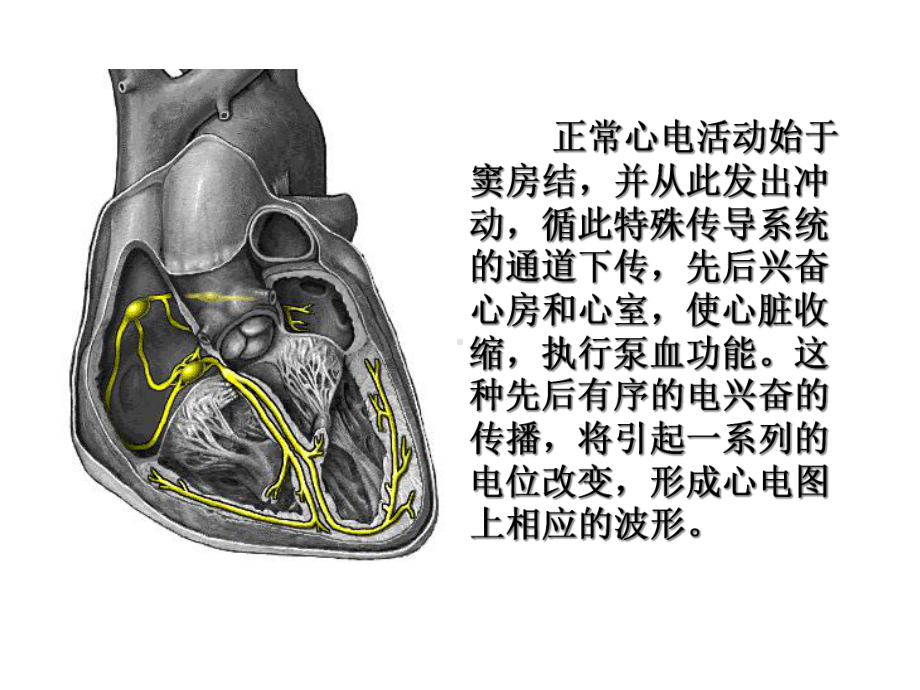 心血管传导系统培训课件.ppt_第3页