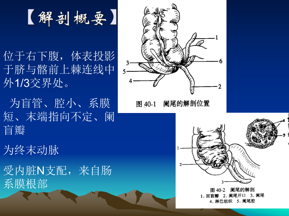 急性阑尾炎全面版课件.ppt_第3页