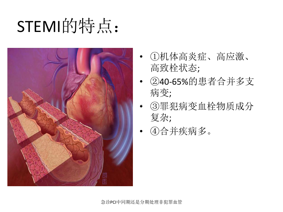 急诊PCI中同期还是分期处理非犯罪血管课件.ppt_第3页